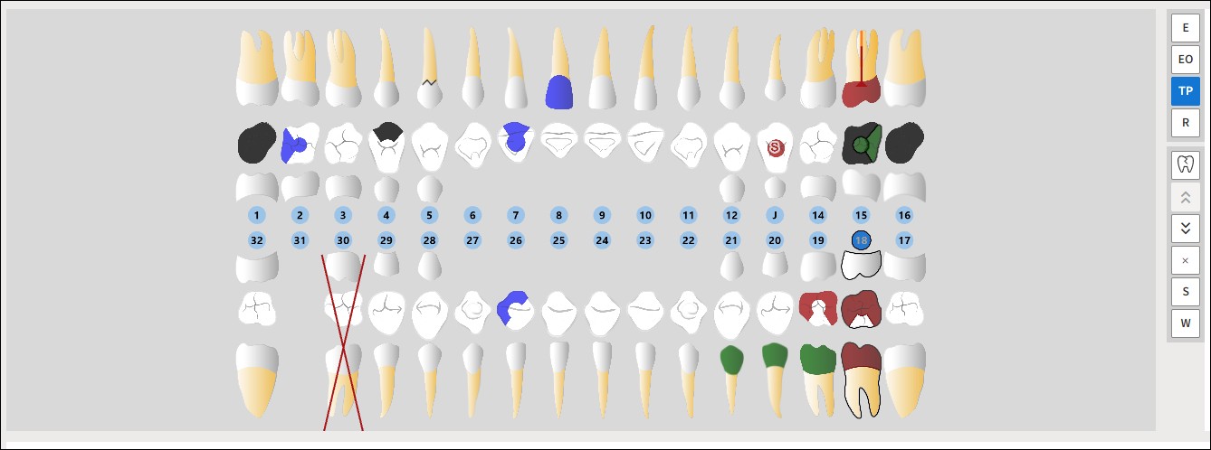 Odontogram image displaying teeth with multiple conditions and needed procedures.